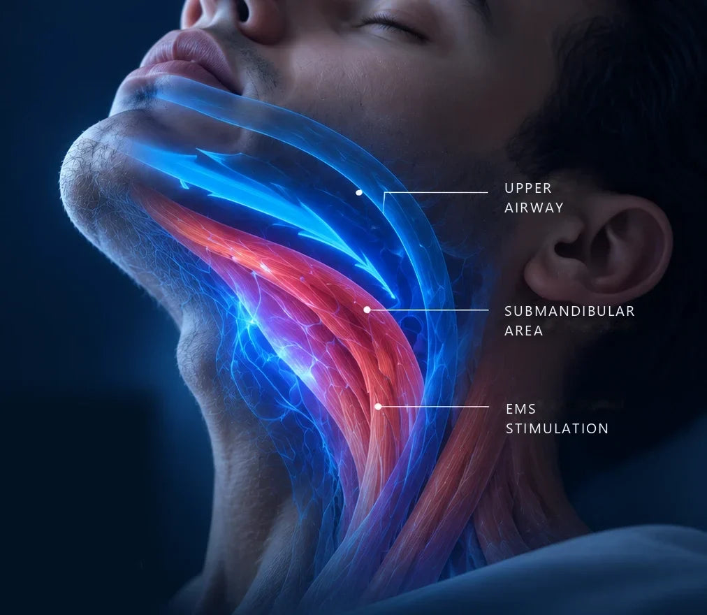 Neck and jaw area with the stimulated muscles highlighted